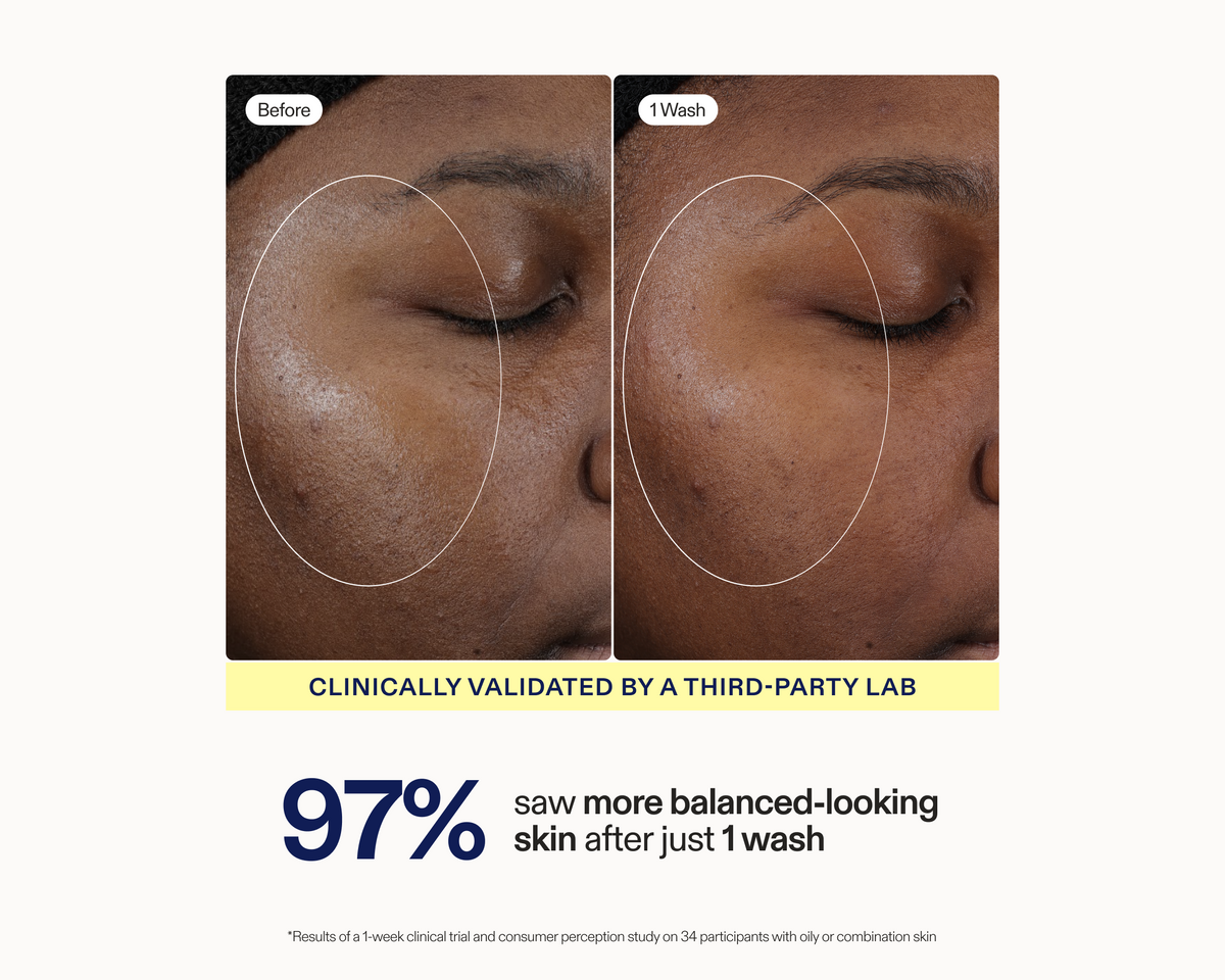 Side-by-side before and after clinical photos showing visibly more balanced-looking skin on the cheek after 1 wash with Skinfix Balancing Soft-Foam Clay Cleanser, with text reading: Clinically validated by a third-party lab — 97% saw more balanced-looking skin after just 1 wash.