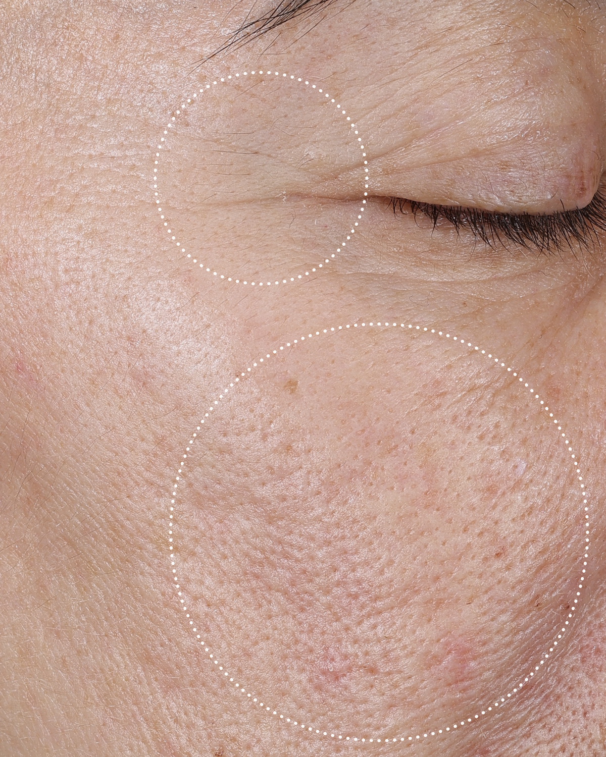 Close-up of a person's face with improved texture and firmer skin